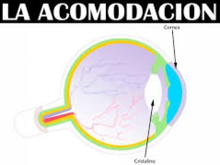 Acomodación