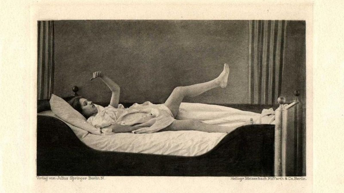 Trastorno de la catatonía asociado con otro trastorno mental