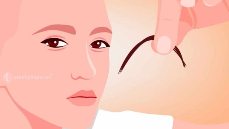 Trastorno de la conducta del tricotilomanía