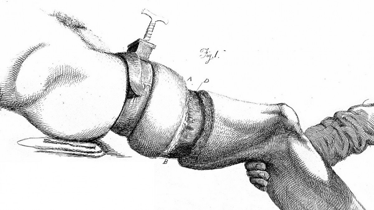 Trastorno de la identidad de la integridad corporal