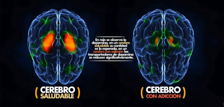 Trastorno del espectro de la adicción a los alucinógenos